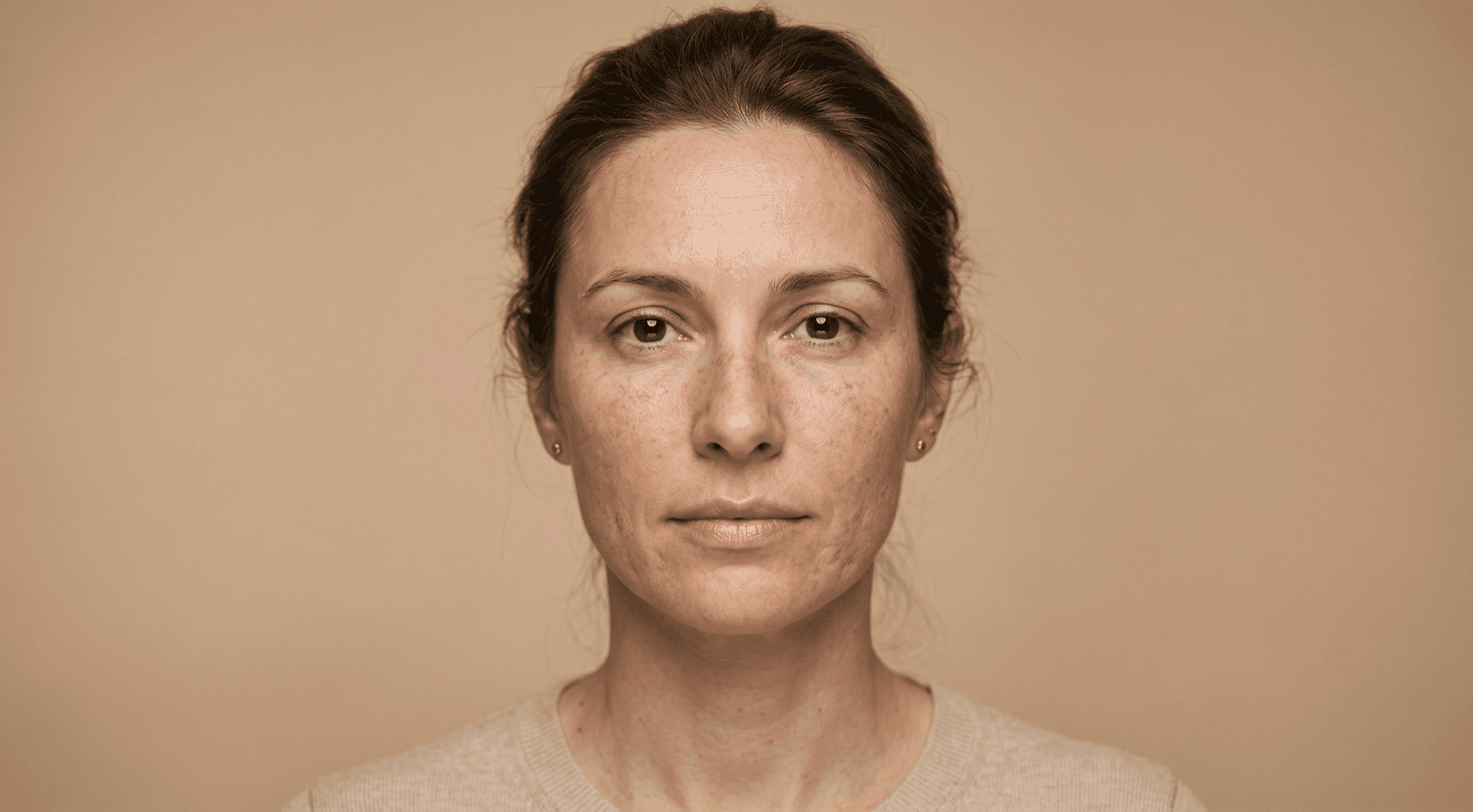Vorher